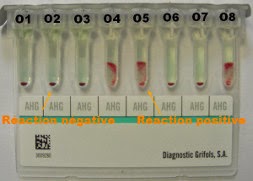 Photo d'une recherche d'anticorps rÃ©alisÃ©e en filtration